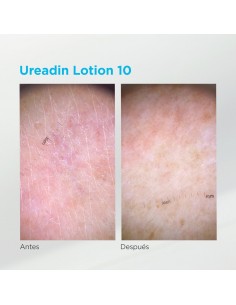 Ureadin 10 100 ml 2