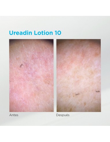 Ureadin 10 100 ml