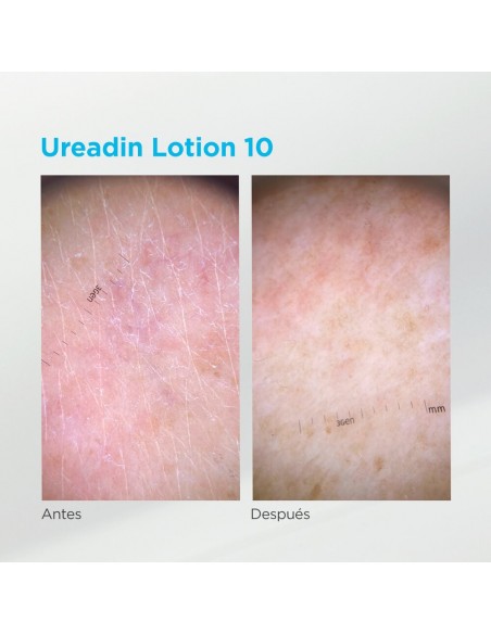 Ureadin 10 100 ml