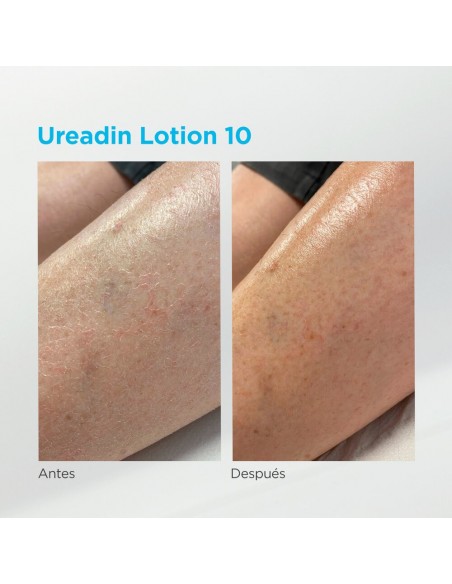 Ureadin 10 100 ml