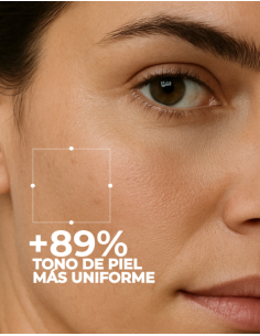 Segle Cofre Despigmentante: Clear Skin R + Clear Azelaic 2