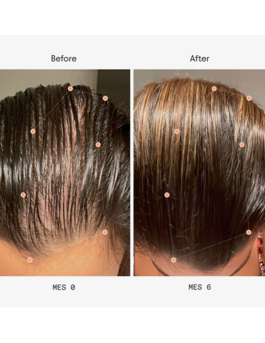 Olistic Mujer 28 viales