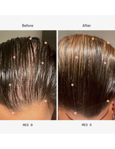 Olistic Mujer 28 viales