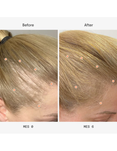 Olistic Next Mujer 28 viales