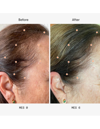 Olistic Next Mujer 28 viales