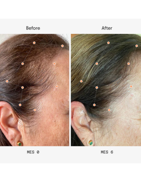 Olistic Next Mujer 28 viales