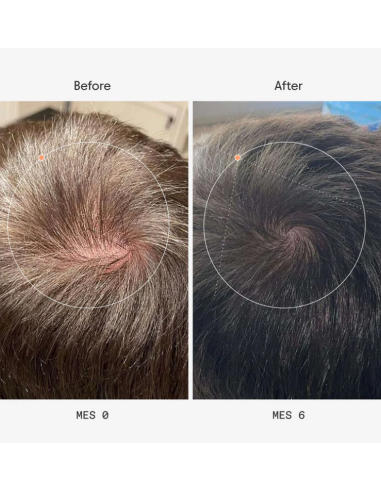 Olistic Hombre 28 viales