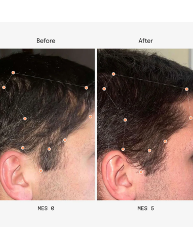 Olistic Hombre 28 viales