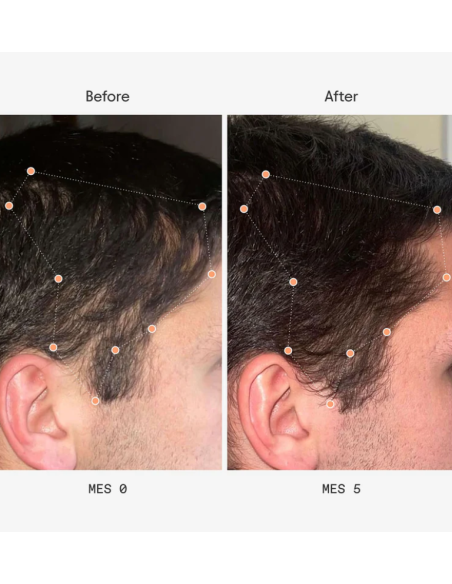 Olistic Hombre 28 viales