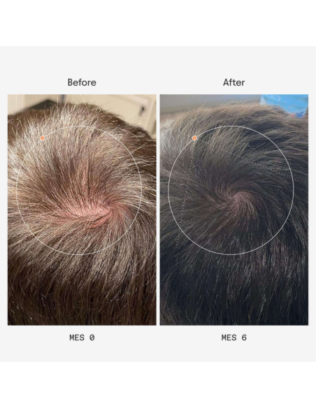 Olistic Hombre Pack 3x28 viales