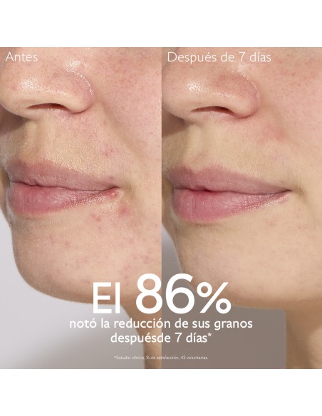 Caudalie Cofre Vinopure Serum + Tonico 200 ml