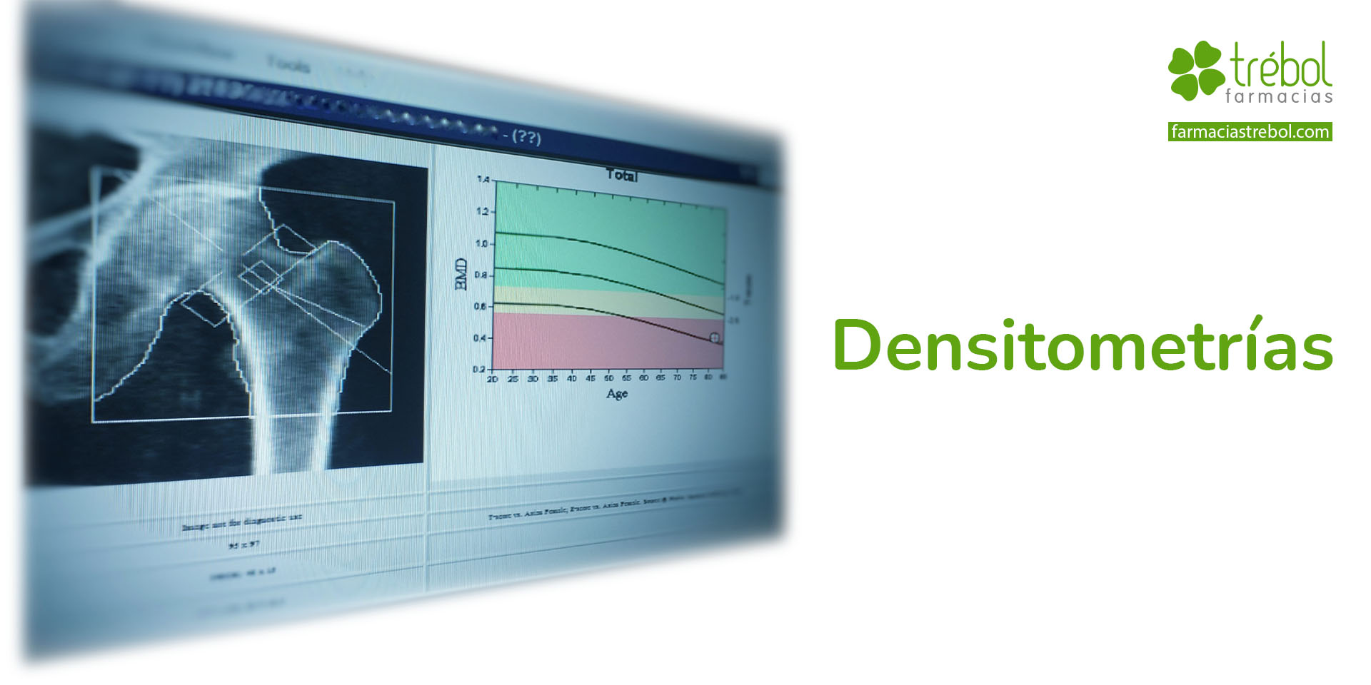 Densitometría en Farmacias Trébol Fuengirola - Farmacias Trébol