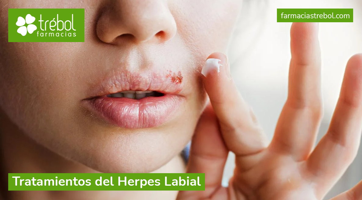 Tratamientos del herpes labial Farmacias Trébol