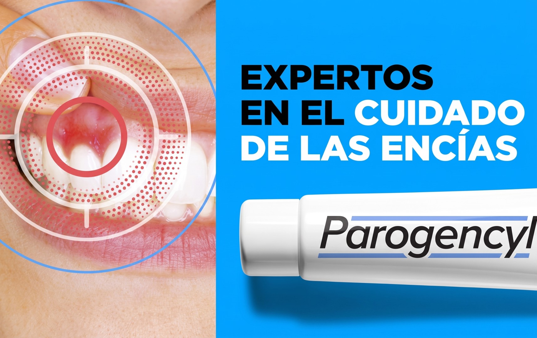 Parogencyl